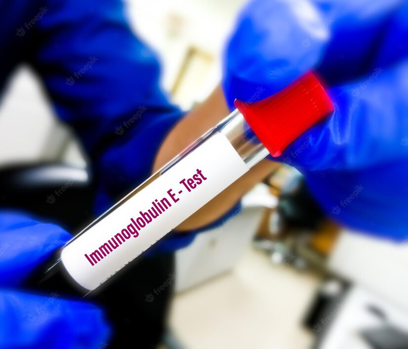 IgE (Immunoglobulin E)